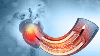 Anjiyo tedavi değil, bir tanı yöntemidir