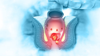 Hemoroid (Basur) Nedir? Neden Olur? Basura Ne İyi Gelir?