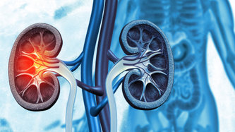 Böbrek Kanseri Nedir? Böbrek Kanseri Belirtileri Nelerdir?