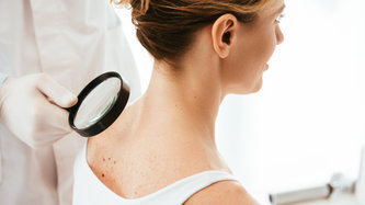 Cilt (Deri) Kanseri Nedir? Cilt Kanseri Belirtileri Nelerdir?