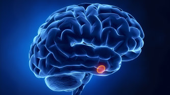 Hipofiz Bezi Tümörü Nedir? Belirtileri ve Tedavisi