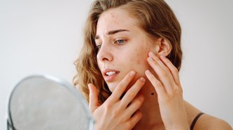 Kistik Sivilce Nedir? Kistik Sivilce Nasıl Geçer?