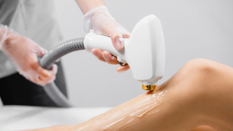 Lazer Epilasyon Nedir? Lazer Epilasyon Zararlı mı?