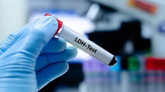 LDH Nedir? LDH Yüksekliği ve Düşüklüğü Ne Anlama Gelir?