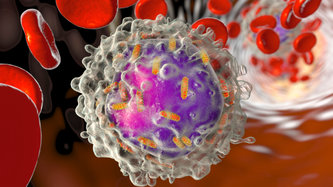 Lösemi (Kan Kanseri) Nedir? Lösemi Belirtileri Nelerdir?