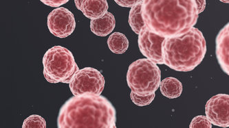 Merkel Hücreli Karsinom Nedir? Merkel Hücreli Karsinom Tedavisi