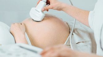 Prenses Doğum (Epidural Normal Doğum) Nedir?