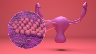 Rahim Duvarı Kalınlaşması Nedir? Belirtileri ve Tedavisi