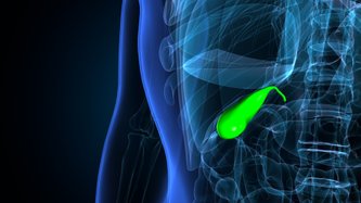 Safra Kesesi Taşı Nedir? Belirtileri ve Tedavisi