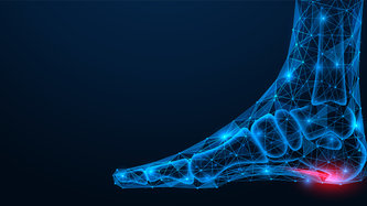 Topuk Dikeni Nedir? Topuk Dikeni Neden Olur?