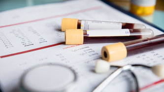 Üre Nedir? Üre Düşüklüğü ve Yüksekliği