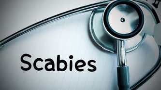 Uyuz Neden Olur? Uyuz Nasıl Bulaşır?