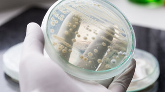 Vajinal Mantar Nedir? Vajinal Mantar Belirtileri Nelerdir?