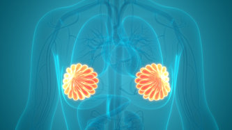 Yoğun Meme Dokusu (Dens Meme)