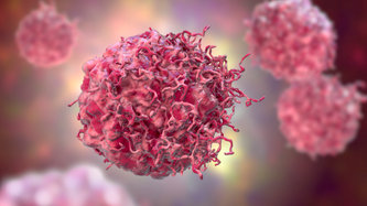 Yumuşak Doku Kanseri (Sarkom) Nedir? Belirtileri ve Tedavisi