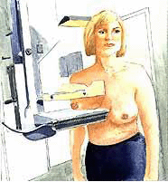 Mamogram1