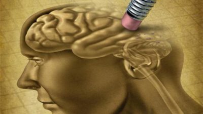 Alzheimer Hastalığındaki Bozulma Değişiklikleri
